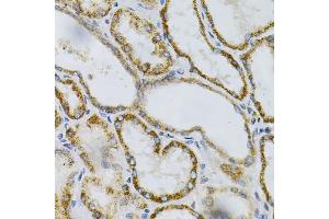 Immunohistochemistry (IHC) image for anti-Protein tyrosine Phosphatase, Receptor Type, A (PTPRA) (AA 20-142) antibody (ABIN1682399)