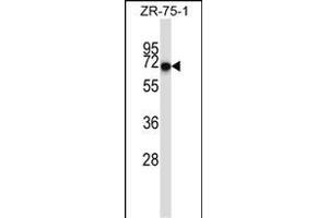 CD5 Antibody (Center) (ABIN657456 and ABIN2846483) western blot analysis in ZR-75-1 cell line lysates (35 μg/lane). (CD5 Antikörper  (AA 203-232))