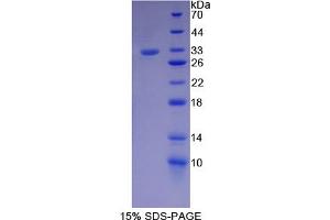 Image no. 1 for SR-Related CTD-Associated Factor 11 (SCAF11) (AA 944-1148) protein (His tag) (ABIN6238270)