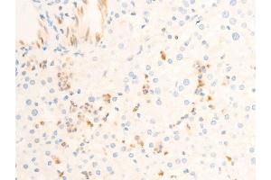 ABIN6267302 at 1/100 staining human liver tissue sections by IHC-P. (ICAM1 Antikörper  (pTyr512))