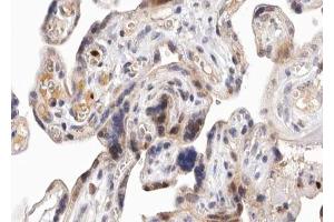 ABIN6267653 at 1/100 staining human Placenta tissue sections by IHC-P. (PKD1/2/3/PKC mu (pSer738), (pSer742) Antikörper)