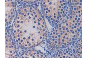 DAB staining on IHC-P; Samples: Mouse Testis Tissue (Fatty Acid Synthase Antikörper  (AA 2257-2504))