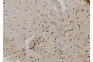 ABIN6279296 at 1/100 staining Mouse liver tissue by IHC-P. (CHD8 Antikörper  (C-Term))