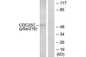 Western blot analysis of extracts from HuvEc cells treated with serum 20% 30', using CDC25C (Phospho-Ser216) Antibody. (CDC25C Antikörper  (pSer216))