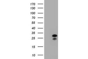 Image no. 2 for anti-Zinc Finger, AN1-Type Domain 5 (ZFAND5) antibody (ABIN1501812) (ZFAND5 Antikörper)