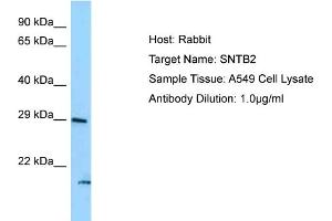 Host: Rabbit Target Name: SNTB2 Sample Type: A549 Whole Cell lysates Antibody Dilution: 1. (SNTB2 Antikörper  (N-Term))