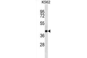 Western Blotting (WB) image for anti-SEC14-Like 4 (SEC14L4) antibody (ABIN2997236) (SEC14L4 Antikörper)