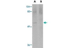 Western blot analysis of MATN4 in rat brain tissue lysate with MATN4 polyclonal antibody  at 1 ug/mL in (A) the absence and (B) the presence of blocking peptide. (MATN4 Antikörper  (N-Term))