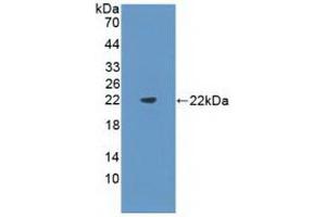 Detection of Recombinant Flt3L, Mouse using Polyclonal Antibody to FMS Like Tyrosine Kinase 3 Ligand (Flt3L) (FLT3LG Antikörper  (AA 27-189))