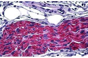Human Pancreas, Peripheral Nerve: Formalin-Fixed, Paraffin-Embedded (FFPE)