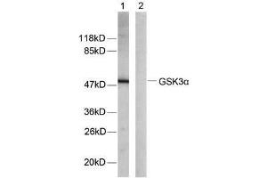 Western blot analysis of extracts from ovary cancer cells using GSK3α (Ab-21) antibody (E021007) (GSK3 alpha Antikörper)