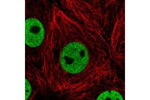 Immunofluorescent staining of MCF7 cells with HNRNPC monoclonal antibody, clone CL2593  (Green) shows distinct nuclear (without nucleoli). (HNRNPC Antikörper)