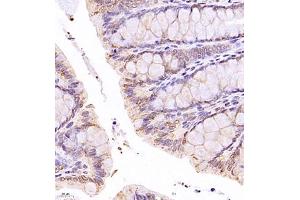 Immunohistochemistry of paraffin embedded rat rectum using SR140 (ABIN7076091) at dilution of 1:1000 (400x lens) (SR140 Antikörper)