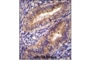 Immunohistochemistry (Paraffin-embedded Sections) (IHC (p)) image for anti-Prostaglandin-Endoperoxide Synthase 2 (Prostaglandin G/H Synthase and Cyclooxygenase) (PTGS2) (AA 363-391) antibody (ABIN655500)