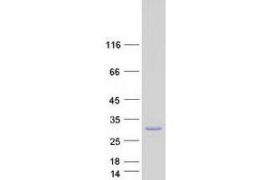 Validation with Western Blot (BCAP31 Protein (Transcript Variant 3) (Myc-DYKDDDDK Tag))