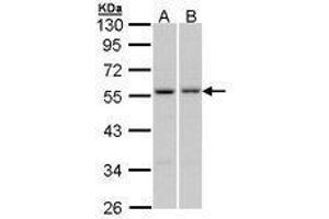 Image no. 1 for anti-Paired Box 6 (PAX6) (AA 1-221) antibody (ABIN467590) (PAX6 Antikörper  (AA 1-221))