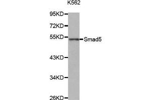 Western Blotting (WB) image for anti-SMAD, Mothers Against DPP Homolog 5 (SMAD5) (AA 140-240) antibody (ABIN1682808) (SMAD5 Antikörper  (AA 140-240))