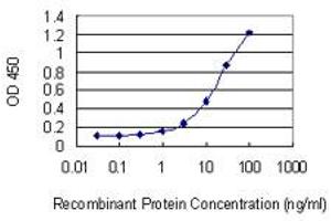 Detection limit for recombinant GST tagged CCNT2 is 0. (Cyclin T2 Antikörper  (AA 264-370))
