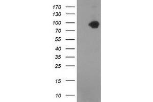 Western Blotting (WB) image for anti-Catenin (Cadherin-Associated Protein), beta 1, 88kDa (CTNNB1) antibody (ABIN1496888)