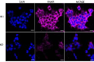 anti-PRKC, Apoptosis, WT1, Regulator (PAWR) antibody