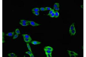 Immunofluorescence (IF) image for anti-T Cell Immunoreceptor with Ig and ITIM Domains (TIGIT) (AA 22-141) antibody (ABIN7171345)