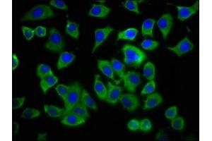 Immunofluorescence staining of A549 cells with ABIN7143338 at 1:233, counter-stained with DAPI. (ADCY8 Antikörper  (AA 534-670))