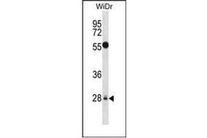 Western blot analysis of MED6 Antibody (Center) in WiDr cell line lysates (35ug/lane). (MED6 Antikörper  (Middle Region))