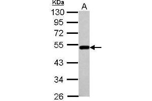 WB Image Sample (30 ug of whole cell lysate) A: A549 10% SDS PAGE antibody diluted at 1:1000 (BLMH Antikörper)