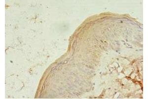 Immunohistochemistry of paraffin-embedded human skin tissue using ABIN7173373 at dilution of 1:100 (TCHP Antikörper  (AA 1-498))