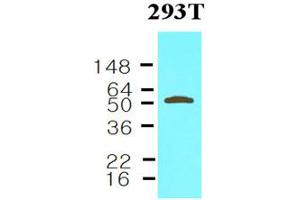 Western blot analysis: Cell lysates of 293T (30ug) were resolved by SDS-PAGE, transferred to NC membrane and probed with anti-human Visfatin (1:1000). (NAMPT Antikörper)