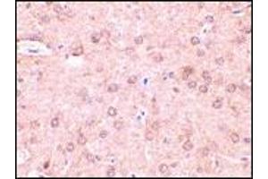 AP20054PU-N Beclin-1 antibody staining of Rat brain tissue by Immunohistochemistry at 2 μg/ml. (Beclin 1 Antikörper  (N-Term))