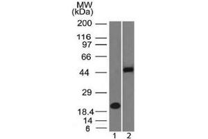 Western blot testing of 1) human partial recombinant protein and 2) human Raji cell lysate with PAX8 antibody (clone PAX8/1492). (PAX8 Antikörper  (AA 60-261))