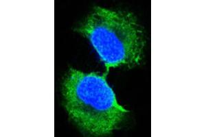 Immunocytochemistry (ICC) image for anti-Glutathione S-Transferase pi 1 (GSTP1) antibody (ABIN2983291) (GSTP1 Antikörper)