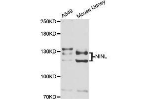 Western blot analysis of extracts of various cell lines, using NINL antibody (ABIN5974637) at 1/1000 dilution. (NINL Antikörper)