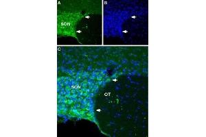Expression of NALCN in rat hypothalamus - Immunohistochemical staining of rat hypothalamus using Anti-NALCN/VGCNL1 (extracellular) Antibody (ABIN7043658 and ABIN7045249).