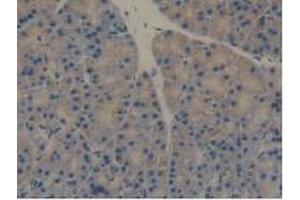 Figure. (REG3B Antikörper  (AA 27-175))