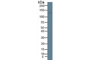 Rabbit Detection antibody from the kit in WB with Positive Control: Human stomach tissue. (ITGA2 ELISA Kit)