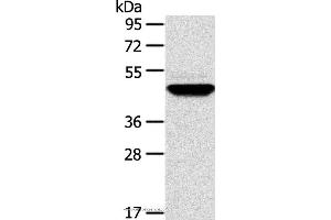 Western blot analysis of Human fetal brain tissue, using TM7SF2 Polyclonal Antibody at dilution of 1:500 (TM7SF2 Antikörper)