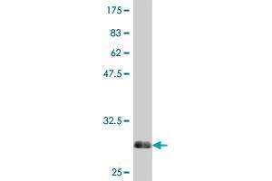 Western Blot detection against Immunogen (30. (SRD5A2 Antikörper  (AA 28-65))