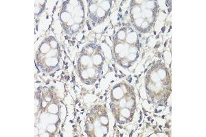 Immunohistochemistry of paraffin-embedded human colon using PTK2 antibody. (FAK Antikörper  (AA 700-800))