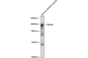 Western blot analysis of extracts of mouse skeletal muscle, using TRPM7 antibody (ABIN6127694, ABIN6149588, ABIN6149589 and ABIN6214200) at 1:1000 dilution. (TRPM7 Antikörper  (AA 756-855))