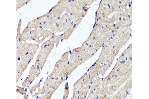 Immunohistochemistry of paraffin-embedded Mouse heart using ACSS2 Polyclonal Antibody at dilution of 1:100 (40x lens). (ACSS2 Antikörper)