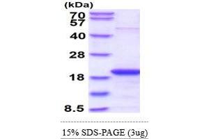 SDS-PAGE (SDS) image for S-Phase Kinase-Associated Protein 1 (SKP1) (AA 1-160) protein (ABIN666914) (SKP1 Protein (AA 1-160))
