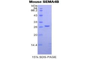 SDS-PAGE (SDS) image for Sema Domain, Immunoglobulin Domain (Ig), Transmembrane Domain (TM) and Short Cytoplasmic Domain, (Semaphorin) 4B (SEMA4B) (AA 31-240) protein (His tag) (ABIN2122064)