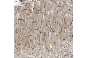 Immunohistochemical staining (Formalin-fixed paraffin-embedded sections) of human heart muscle with TSPAN9 polyclonal antibody  shows moderate positivity in intercalated discs. (Tetraspanin 9 Antikörper  (AA 123-200))