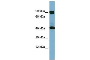 Western Blotting (WB) image for anti-Isovaleryl-CoA Dehydrogenase (IVD) (N-Term) antibody (ABIN2787703) (IVD Antikörper  (N-Term))