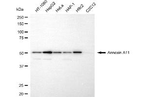Western blotting analysis using annexin A11 antibody (ABIN7797616).
