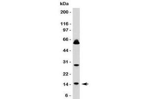 Western blot testing of SUMO1 antibody and HeLa lysate. (SUMO1 Antikörper)