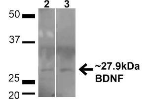 Western blot analysis of Human HeLa and HEK293T cell lysates showing detection of ~27. (BDNF Antikörper  (N-Term) (Atto 594))