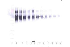 Image no. 1 for anti-Intercellular Adhesion Molecule 1 (ICAM1) antibody (ABIN465660) (ICAM1 Antikörper)